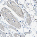 Anti-ESYT1 Antibody