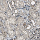 Anti-CTIF Antibody