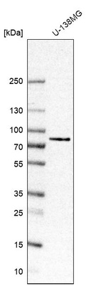 Anti-CTIF Antibody