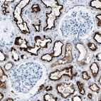 Anti-C21orf62 Antibody