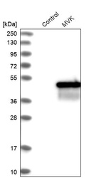 Anti-MVK Antibody