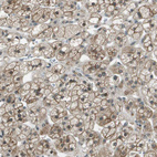 Anti-SDC3 Antibody