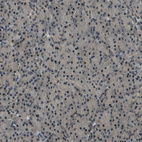 Anti-SDC3 Antibody