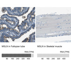 Anti-MSLN Antibody