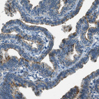 Immunohistochemical staining of human fallopian tube shows strong cytoplasmic positivity in glandular cells.