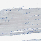 Immunohistochemical staining of human skeletal muscle shows no cytoplasmic positivity in myocytes as expected.