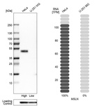 Western blot analysis in human cell lines HeLa and U-251MG using Anti-MSLN antibody. Corresponding MSLN RNA-seq data are presented for the same cell lines. Loading control: Anti-GAPDH.