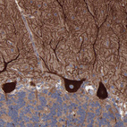 Anti-TMEM268 Antibody