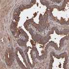 Anti-TMEM268 Antibody