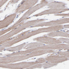 Anti-TMEM268 Antibody