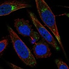 Anti-LRP11 Antibody