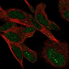 Anti-VSTM4 Antibody