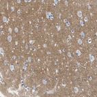 Anti-GPM6A Antibody