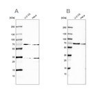 Anti-SNW1 Antibody