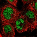 Anti-SNW1 Antibody