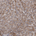 Anti-ITIH3 Antibody