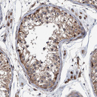 Anti-ITIH3 Antibody