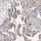 Anti-MGAT1 Antibody