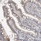 Anti-MGAT1 Antibody