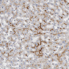 Anti-MGAT1 Antibody