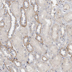 Anti-MGAT1 Antibody