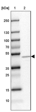 Anti-MGAT1 Antibody