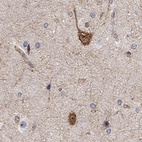 Anti-STXBP6 Antibody