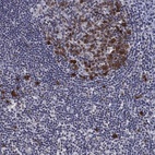 Anti-TYMS Antibody