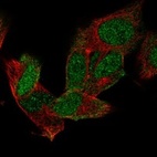 Anti-MSI1 Antibody