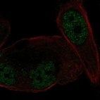 Anti-NR3C2 Antibody