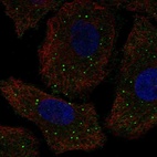 Anti-GALNT9 Antibody