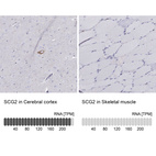 Anti-SCG2 Antibody