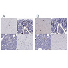 Anti-SCG2 Antibody