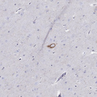 Anti-SCG2 Antibody