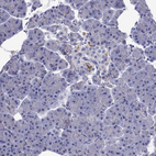 Anti-SCG2 Antibody