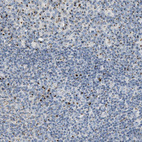 Anti-ENTPD4 Antibody