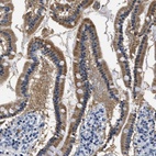 Anti-HS3ST2 Antibody