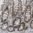 Anti-NDRG3 Antibody