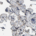 Anti-NDRG3 Antibody