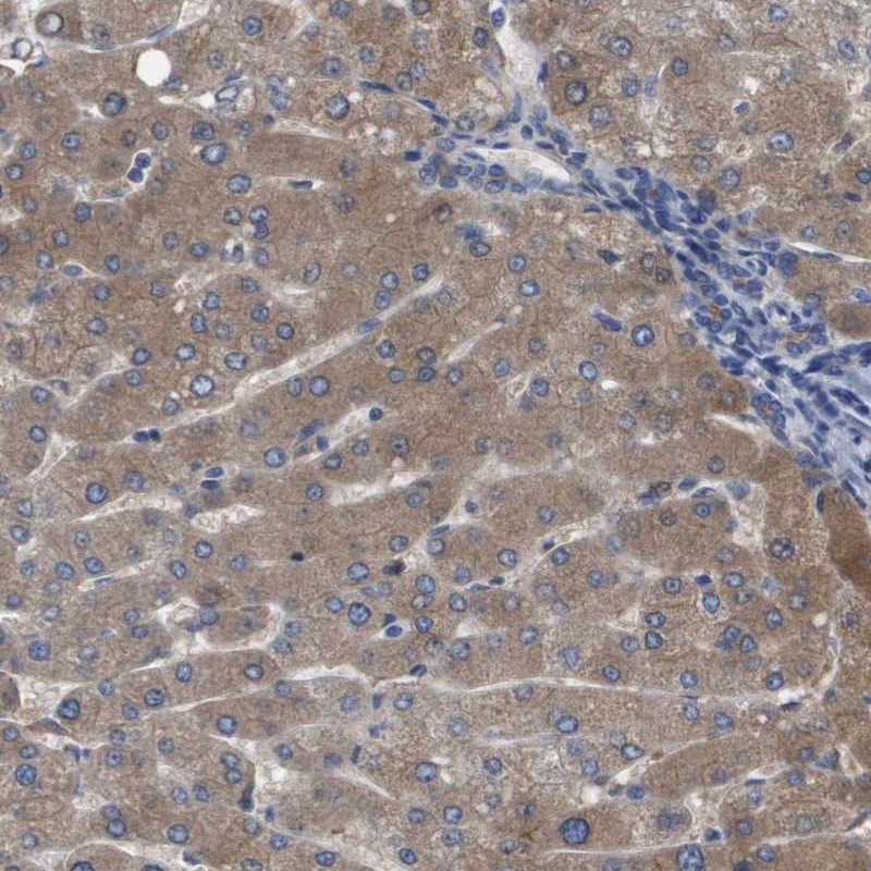 Anti-SERPINA6 Antibody