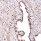 Anti-TNRC6A Antibody