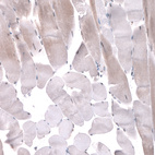 Anti-TNRC6A Antibody