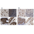 Anti-KTN1 Antibody