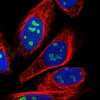 Anti-CSRNP3 Antibody