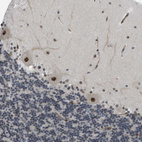 Immunohistochemical staining of human cerebellum shows strong nuclear positivity in Purkinje cells.