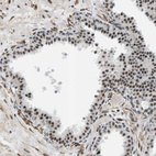 Immunohistochemical staining of human prostate shows moderate nuclear positivity in glandular cells.