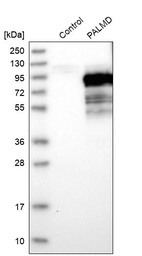 Anti-PALMD Antibody