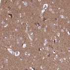 Anti-SGIP1 Antibody