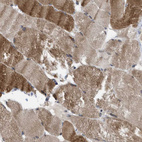 Anti-TMEM159 Antibody