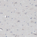 Anti-TMEM159 Antibody